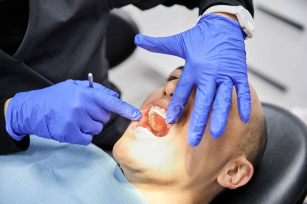 Best Root Canal Emergency Dentist  in Man, WV